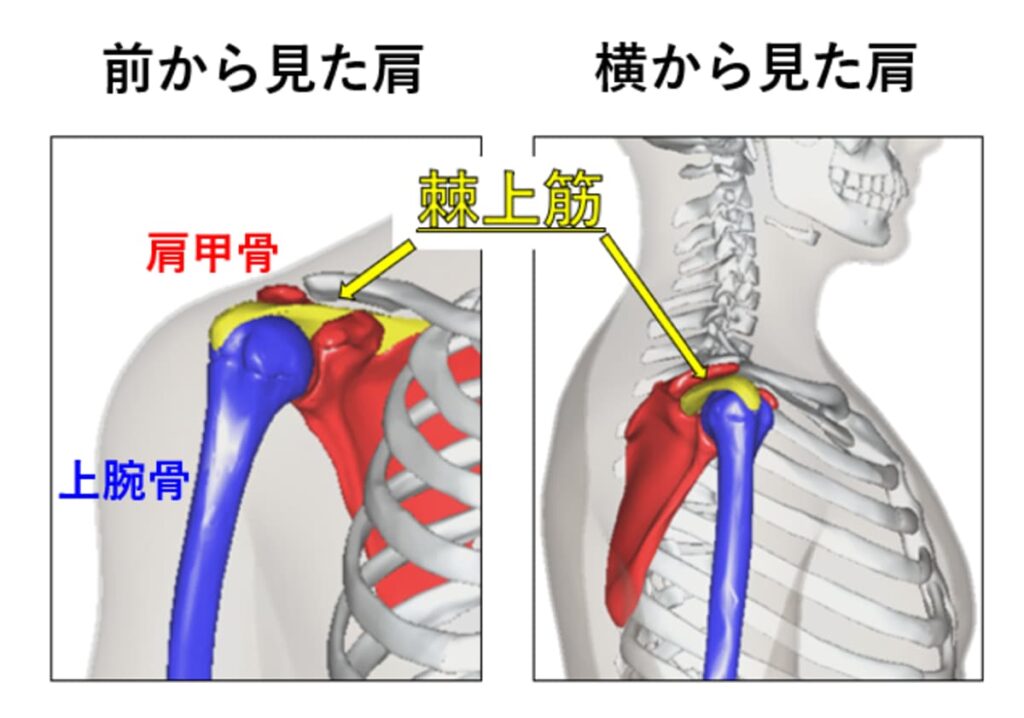 サイドレイズでの肩のインピンジメントの説明